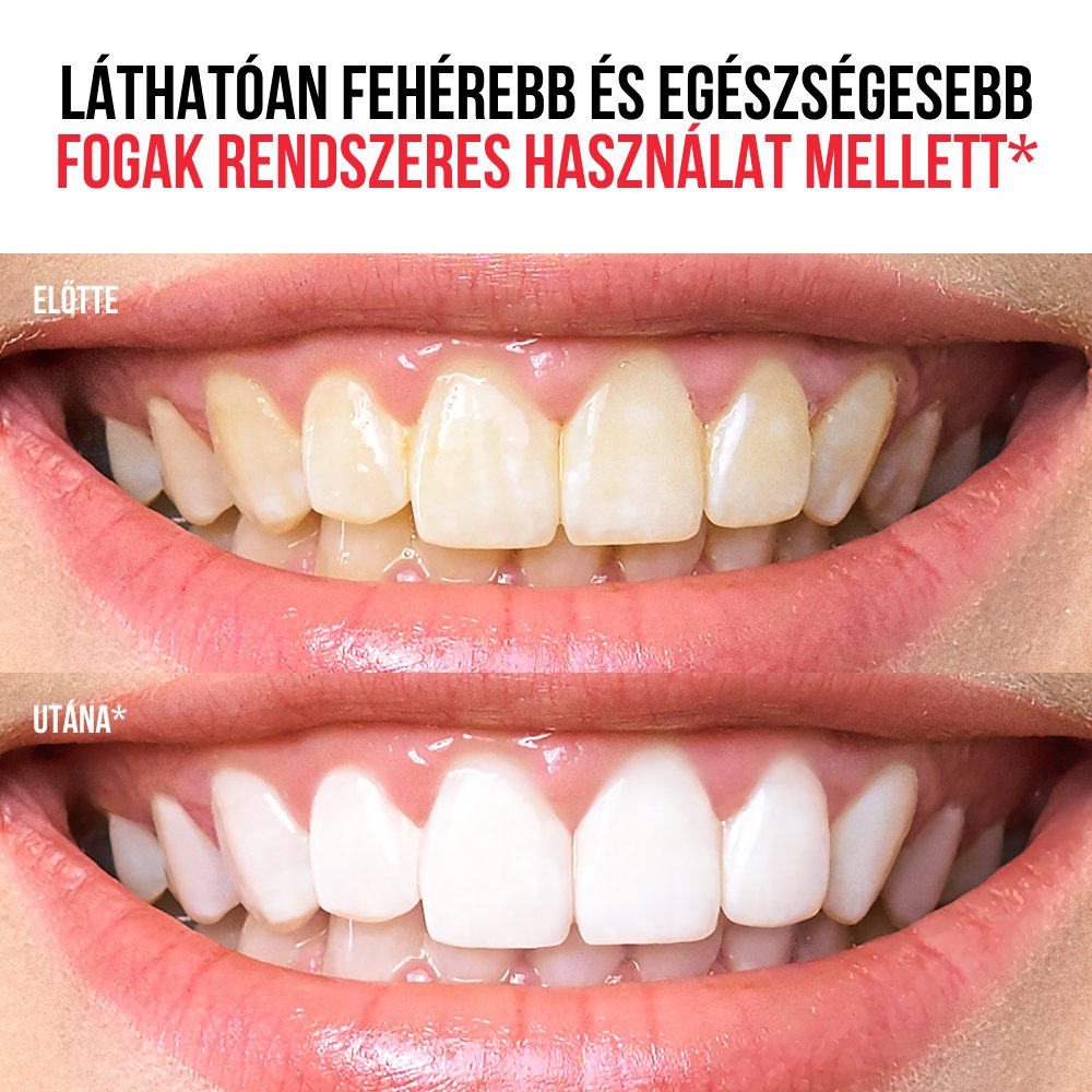 Regeneráló fogkrém 6 az 1-ben